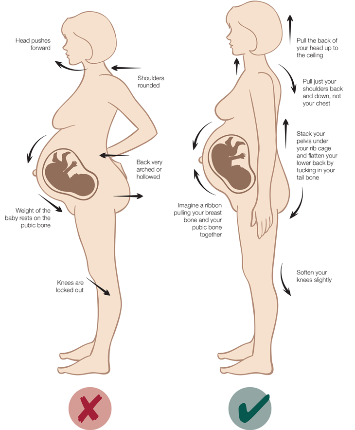 carrying baby low in pelvis 