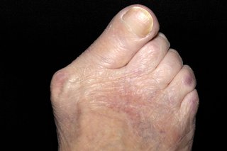 big toe big toe