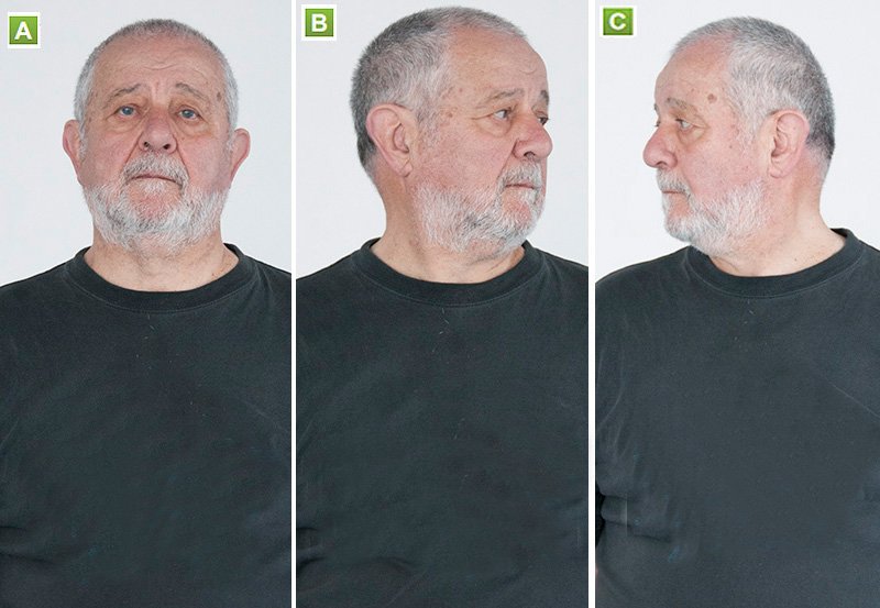 neck rotation